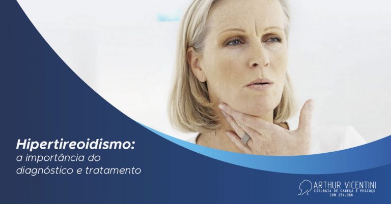 Hipertireoidismo A Import Ncia Do Diagn Stico E Tratamento Dr Arthur Vicentini Crm Sp