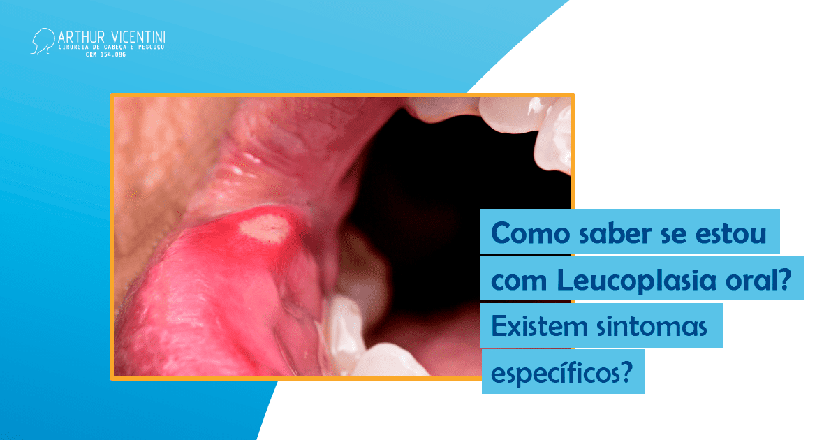 Como Saber Se Estou Leucoplasia Oral Existem Sintomas Específicos