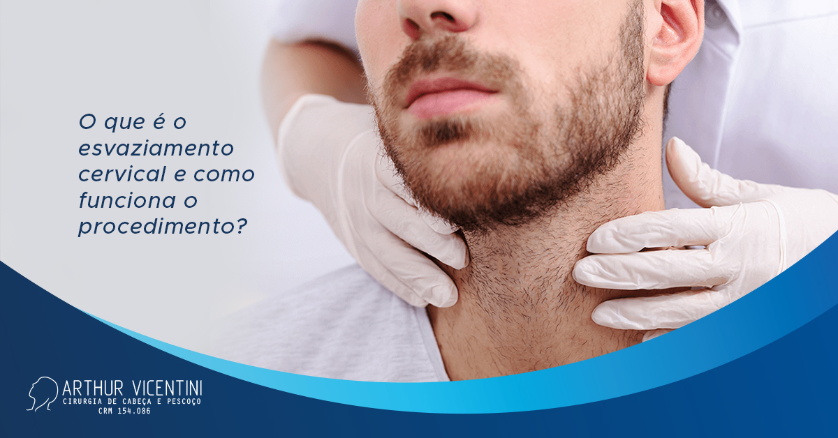 O que é o esvaziamento cervical e como é feito o procedimento? Dr. Arthur Vicentini CRMSP 154086 O que é o esvaziamento cervical e como é feito o procedimento? Dr. Arthur Vicentini CRMSP 154086