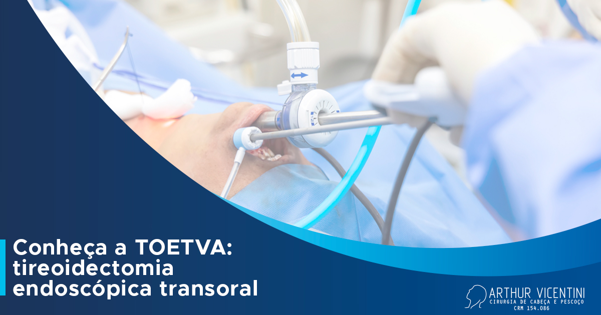 Conheça a TOETVA tireoidectomia endoscópica transoral Dr. Arthur