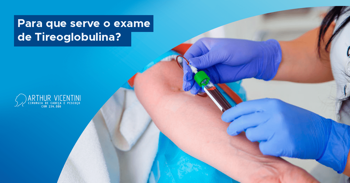 Para Que Serve O Exame De Tireoglobulina? Dr. Arthur Vicentini CRMSP 154086 Para Que Serve O Exame De Tireoglobulina? Dr. Arthur Vicentini CRMSP 154086