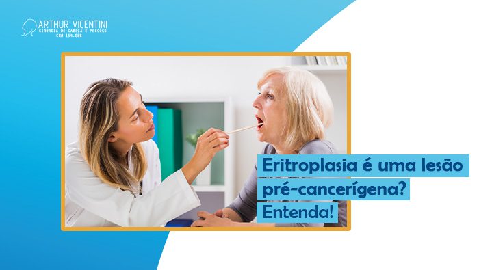 Eritroplasia E Uma Lesao Pre Cancerigena Entenda Dr Arthur Vicentini Bg