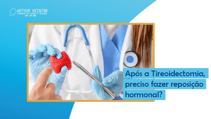 Apos A Tireoidectomia Preciso Fazer Reposicao Hormonal Dr Arthur Vicentini Bg