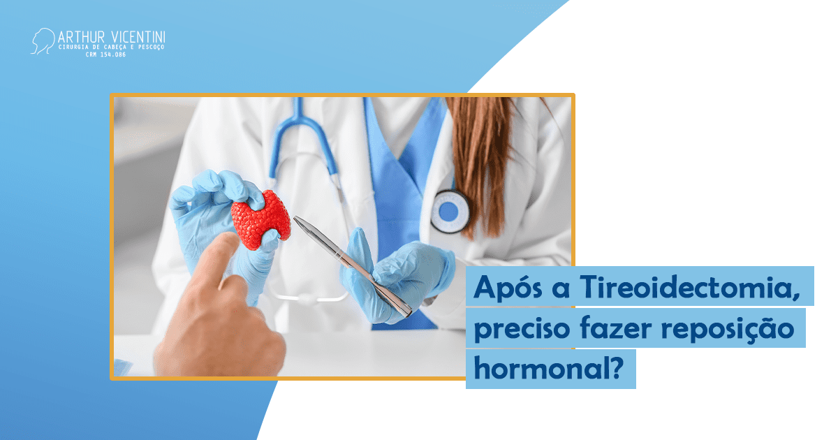 Após A Tireoidectomia, Preciso Fazer Reposição Hormonal? Dr. Arthur