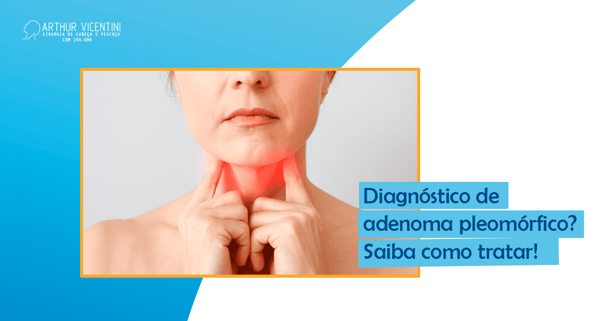 Diagnóstico De Adenoma Pleomórfico Saiba Como Se Tratar Dr Arthur Vicentini Crm Sp 154086 4864