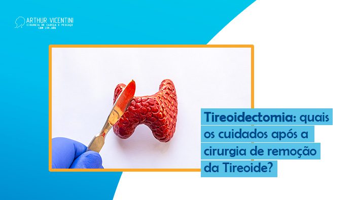 Tireoidectomia Quais Os Cuidados Apos A Cirurgia De Remocao Da Tireoide Dr Arthur Vicentini Bg