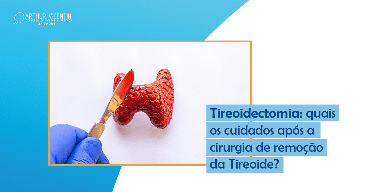 Tireoidectomia Quais Os Cuidados Após A Cirurgia De Remoção Da