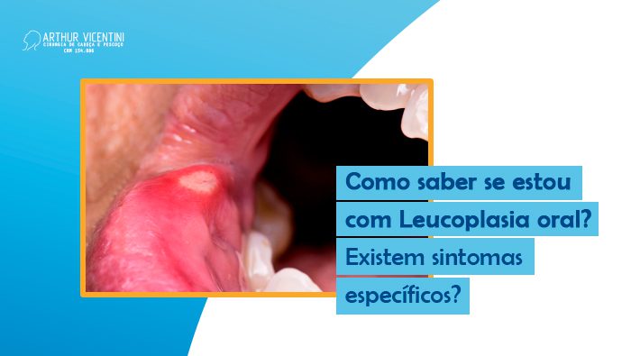 Como Saber Se Estou Com Leucoplasia Oral Existem Sintomas Especificos Dr Arthur Vicentini Bg
