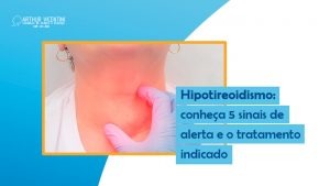 Hipotireoidismo: Conheça 5 Sinais De Alerta E O Tratamento Indicado ...