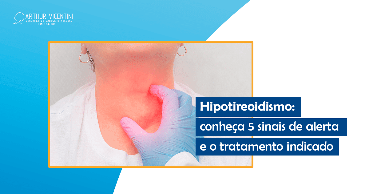 Hipotireoidismo: Conheça 5 Sinais De Alerta E O Tratamento Indicado ...