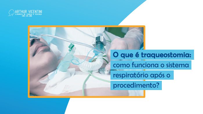 O Que E Traqueostomia Como Funciona O Sistema Respiratorio Apos O Procedimento Dr Arthur Vicentini Bg