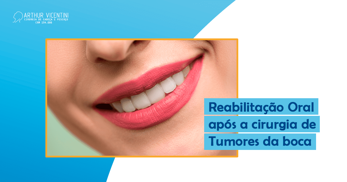 Reabilitacao Oral Apos A Cirurgia De Tumores Da Boca Fb