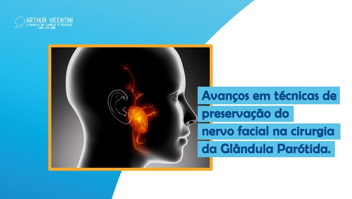 Ilustração De Perfil De Uma Cabeça Humana, Destacando A Glândula Parótida E Seus Nervos Em Laranja Brilhante, Localizada Na Região Da Bochecha, Próxima Ao Ouvido.